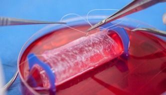 reconstrucción de vagina en laboratorio